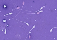 Основные показатели качества спермы